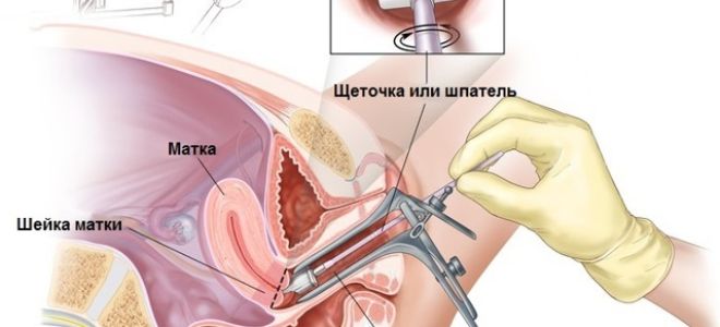 Эритроциты в мазке на флору у женщин: норма, причины повышения