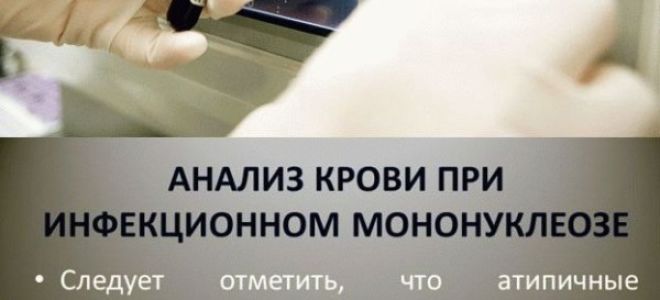 Атипичные мононуклеары в общем анализе крови – что это такое?