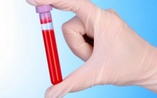 Анализ крови у детей: показатели, что делать если плохой?