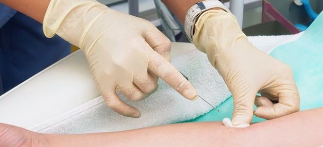 Расшифровка pct в анализе крови: нормы, что показывает?