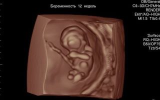 Фото узи на 12 неделе беременности: пол ребенка, норма, расшифровка