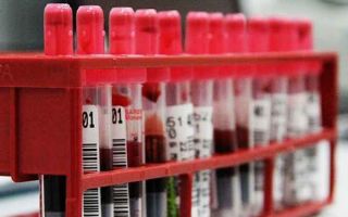 Mid в анализе крови: расшифровка, нормальный уровень