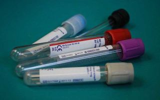 Mcv в анализе крови: расшифровка, нормы, что это такое?