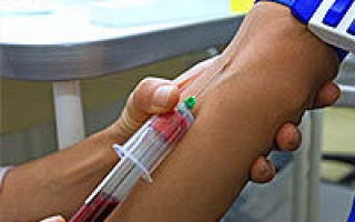 Подготовка к общему анализу крови – что нужно делать?
