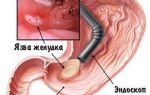 Фгс желудка (фиброгастроскопия): как делается?