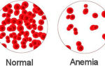 Норма тромбоцитов в крови и отклонение показателей в анализе