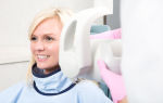 Рентген зуба при беременности: можно ли делать и на каких сроках?