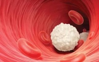 Повышены лейкоциты в крови у ребенка: причины, о чем это говорит и что делать?