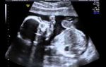 Допплерография при беременности [расшифровка] 8 глав