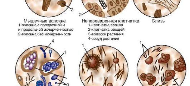 Расшифровка анализа кала у ребенка и взрослого – как их читать?