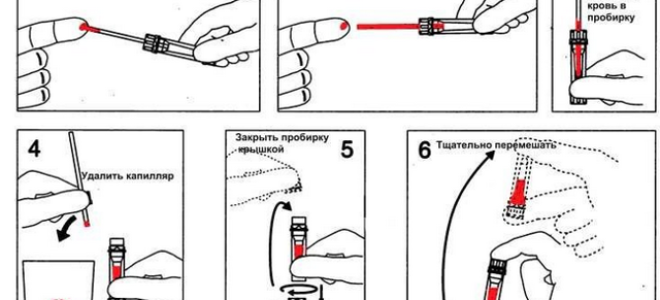 Лейкоциты в мазке у мужчин: норма, причины повышения