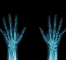 МРТ лучезапястного сустава и кисти руки