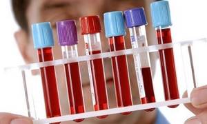 Анализ крови на паразитов – как называется?