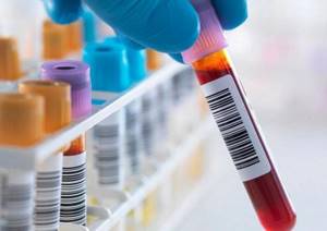 Иммунологический анализ крови: расшифровка, нормы