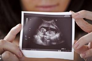 УЗИ на 5 неделе беременности: фото, что покажет?