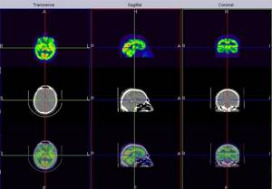 Что лучше КТ или МРТ головного мозга и чем они отличаются?