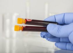 Незрелые гранулоциты в анализе крови – что это такое?