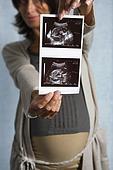 УЗИ в первом триместре беременности: нормы, что видно?
