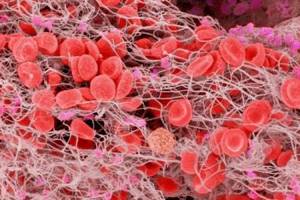 Норма тромбоцитов в крови у мужчин: таблица по возрастам, причины отклонения