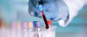 Анализ крови на гепатит: расшифровка, сколько делается, как сдать?