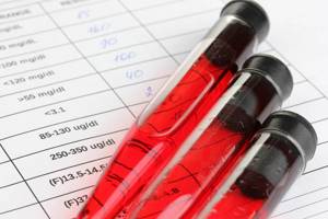 Общий анализ крови с лейкоцитарной формулой