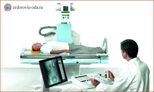 Рентген пояснично-крестцового отдела позвоночника: подготовка, как делают?