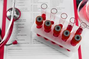 hcv и anti-hcv в анализе крови – что это?