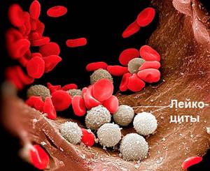 Лейкоциты в крови повышены у мужчин: причины, что предпринять?