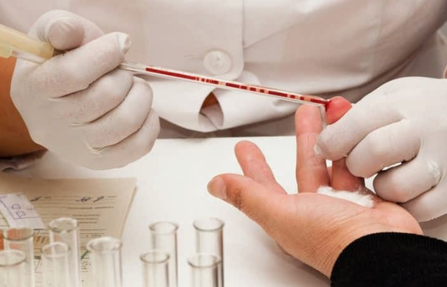 Покажет ли общий анализ крови ВИЧ?