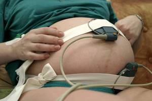 Скрининг при беременности: сроки, когда делают?