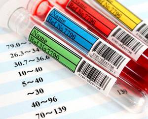 Общий анализ крови при онкологии – показывает ли рак?