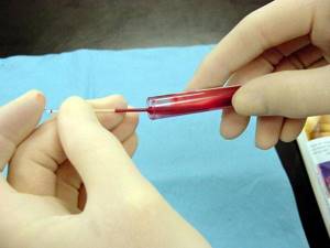 hct в анализе крови: расшифровка, нормы