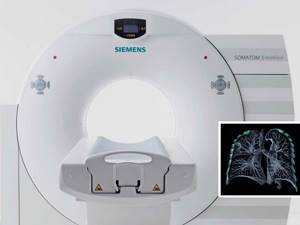 Мультиспиральная компьютерная томография – что это такое?