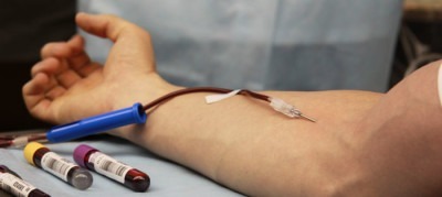rdw в анализе крови: расшифровка, что делать если повышен?