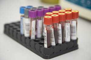 Анализ на гликированный гемоглобин: как сдавать, что показывает?