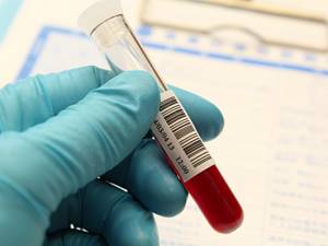 АЛТ и АлАТ в анализе крови – что это?