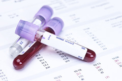 Анализ крови на ТТГ: подготовка, расшифровка