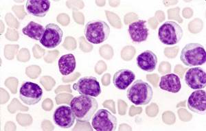 Норма лимфоцитов у детей в крови по возрастам (таблица)