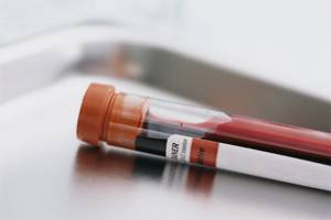 Нормы общего анализа крови у женщин и мужчин: таблицы и пояснения