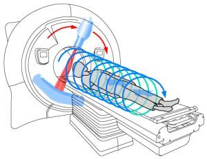 Спиральная компьютерная томография – в чем ее особенности?
