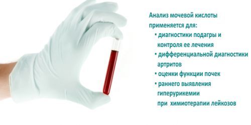 Анализ на мочевую кислоту в крови: подготовка, как сдавать, расшифровка