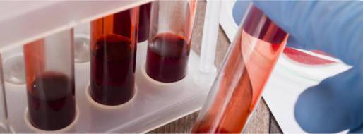 Какой анализ крови показывает онкологию – можно ли ее определить?