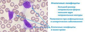 Атипичные лимфоциты в анализе крови: что это такое и почему появляются?