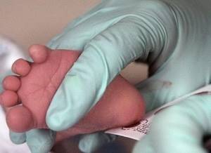 генетический скрининг новорожденных: [что нужно знать]
