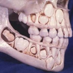 Рентген зубов: как делают и как часто можно? (с фото)