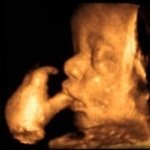 УЗИ в первом триместре беременности: нормы, что видно?