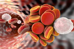 Повышенные тромбоциты у ребенка в крови: причины, что делать?