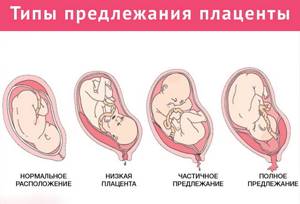 УЗИ на 30 неделе беременности: показатели нормы, размеры, фото