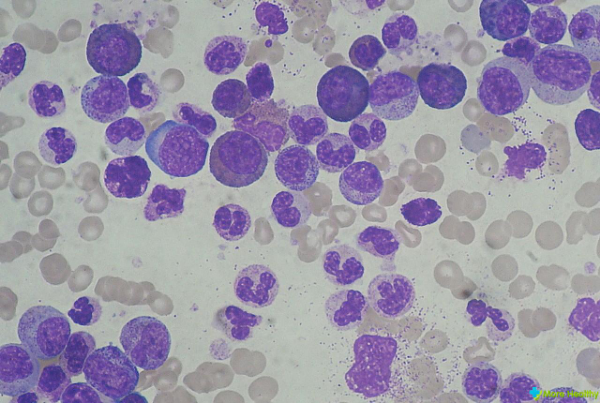 Обозначение лейкоцитов в анализе крови