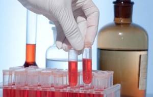 rbc в анализе крови: расшифровка, норма